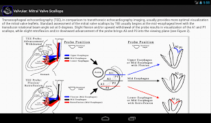 EchoSource স্ক্রিনশট 6