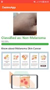 DermoApp: Skincancer detection ภาพหน้าจอ 5