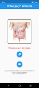 Polyp detector اسکرین شاٹ 6