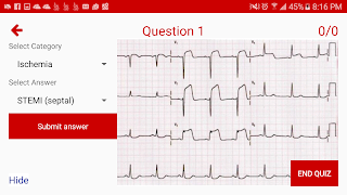 ECG Tools ภาพหน้าจอ 5