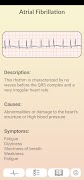ECG Guide screenshot 1