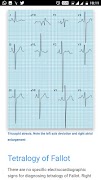 ECG Basics - Full تصوير الشاشة 4