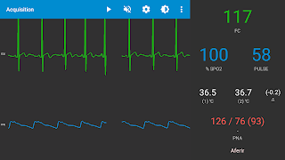 Monitor INpulse پوسٹر