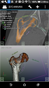 برنامه‌نما DroidRender - 3D DICOM viewer عکس از صفحه