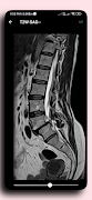 برنامه‌نما DICOM Viewer عکس از صفحه