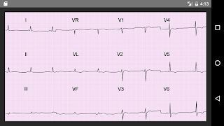 ECG 100 Clinical Cases Ekran Görüntüsü 7