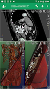 DroidRender - 3D DICOM viewer Ekran Görüntüsü 5