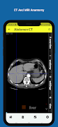 Radiology Anatomy CT And MRI Screenshot 4