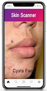 Skin Scanner 截圖 5