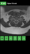 MRI Viewer screenshot 3