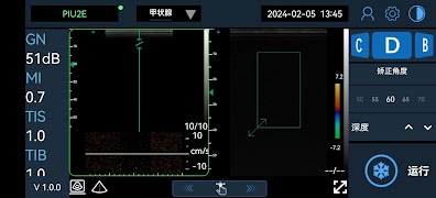 Uscan Pro ภาพหน้าจอ 1