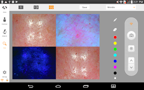 Skinview تصوير الشاشة 6