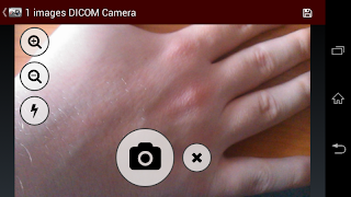 Dicompass DICOM Camera スクリーンショット 7