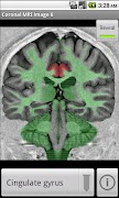 Poster NeuroSlice
