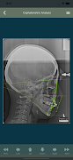 OrthoCeph screenshot 1