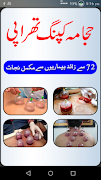 Hijama Cupping Tutorials Screenshot 1