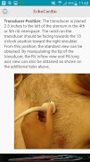 EchoCardio 截图 2