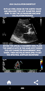 AORTIC STENOSIS PROTOCOL GUIDE скриншот 6