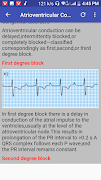 Clinical ECG Guide. スクリーンショット 1