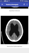 3 Schermata CT Brain Interpretation