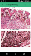 Practical Pathology screenshot 7
