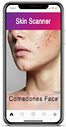 Skin Scanner imagem de tela 4
