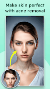 Remove Acne from Face Screenshot 6