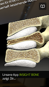 INSIGHT BONE تصوير الشاشة 4