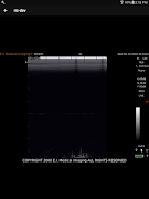 EVOStream ภาพหน้าจอ 5