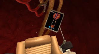 Cebrac 360 Screenshot 1