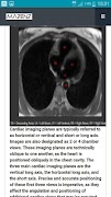 1 Schermata CardioMRI