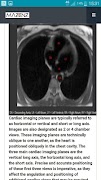 CardioMRI screenshot 1