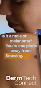 DermTech Connect poster
