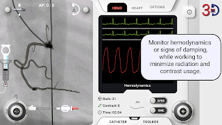AngioAID 3D screenshot 5