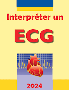 Interpreter un ECG poster