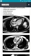 CardioMRI poster