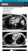 Poster CardioMRI