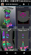 DroidRender - 3D DICOM viewer imagem de tela 7