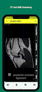 Radiology Anatomy CT And MRI screenshot 1