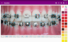 BraceMate screenshot 7