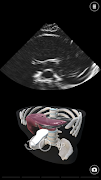 1 Schermata Deepscope Ultrasound Simulator