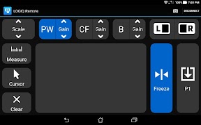برنامه‌نما LOGIQ Remote عکس از صفحه
