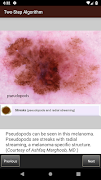 Dermoscopy Two Step Algorithm تصوير الشاشة 5