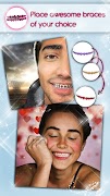 Braces Teeth Photo Editor screenshot 2