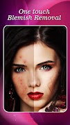Face Blemishes Removal স্ক্রিনশট 6