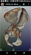 DroidRender - 3D DICOM viewer スクリーンショット 6