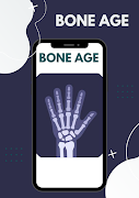 bone age - wrist poster