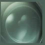 Can mist Ekran Görüntüsü 1