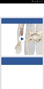 3D Spasticity ภาพหน้าจอ 3
