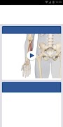 3D Spasticity 截图 3